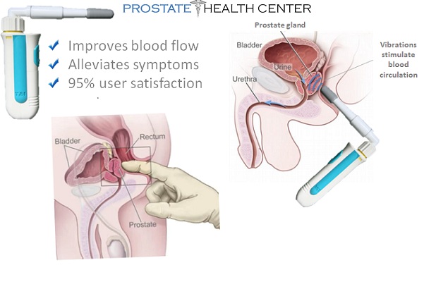 How to stimulate the prostate external